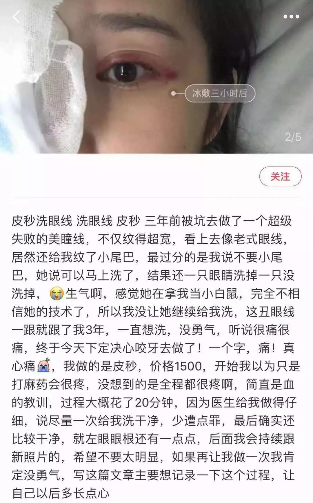 纹眉纹眼线技巧,纹眉纹眼线用什么仪器好