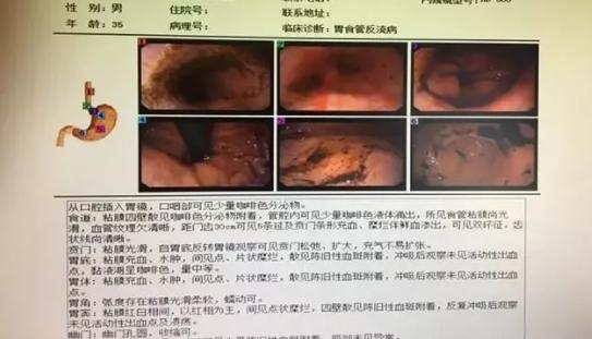 胃嗳气反酸能吃雷贝拉唑钠吗,打嗝胃胀吃雷贝拉唑有效果吗