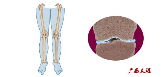听骨科医生讲的话,听完骨科专家的一段话