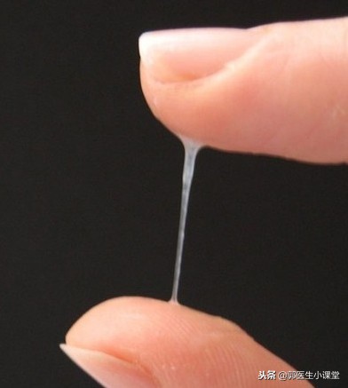 同房后多久可以做妇检？