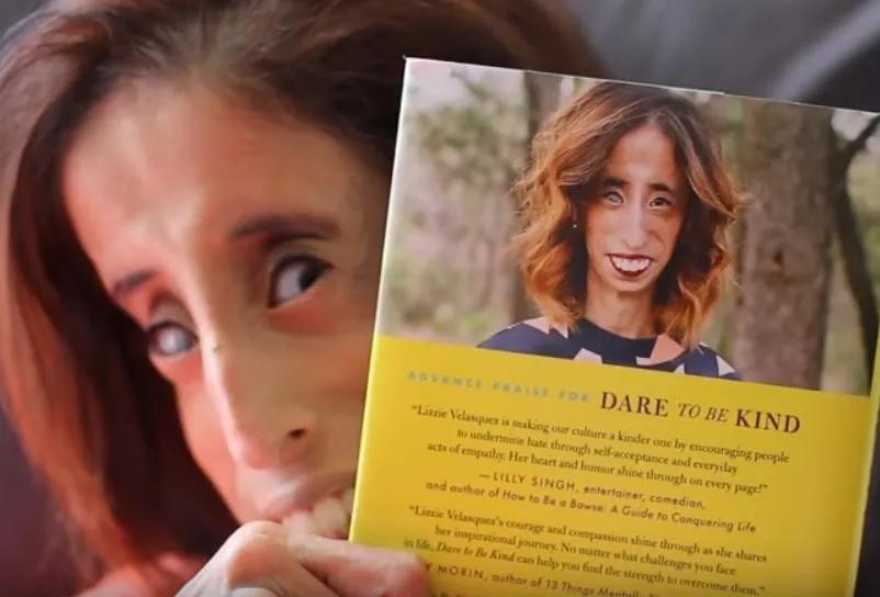 揭秘世界上最丑的女人,世界上最丑的女人背后故事