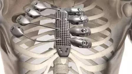 熔炼合金计算公式,高温合金熔炼基本知识