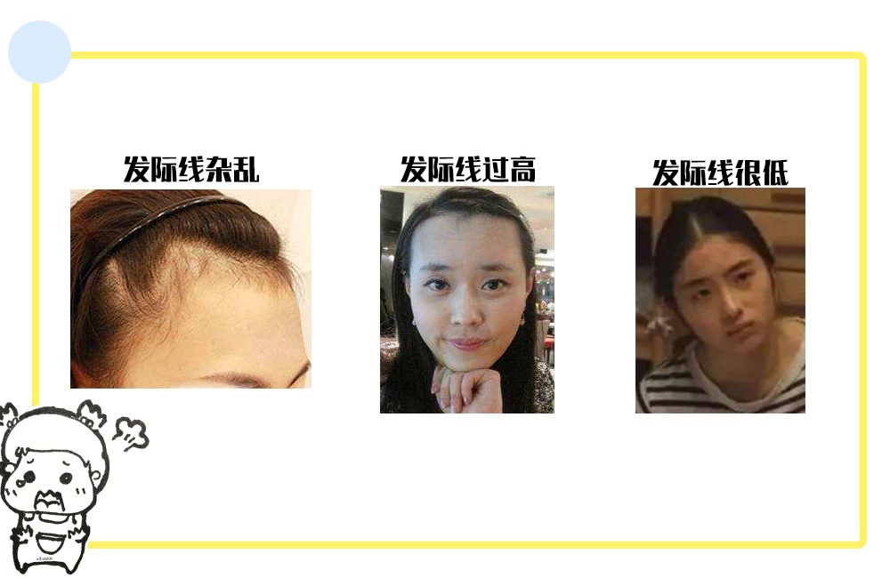 发际线高女生怎么变美,短脸发际线高变美思路