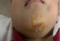 孩子误吞硬币怎么办,孩子误吞硬币怎么解决