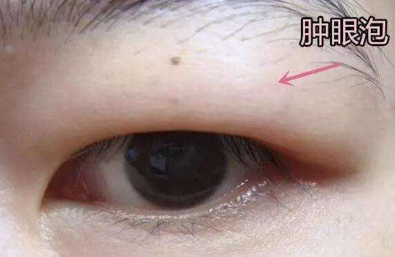 适合内双的隐形双眼皮贴测评,双眼皮专用的双眼皮贴真实测评