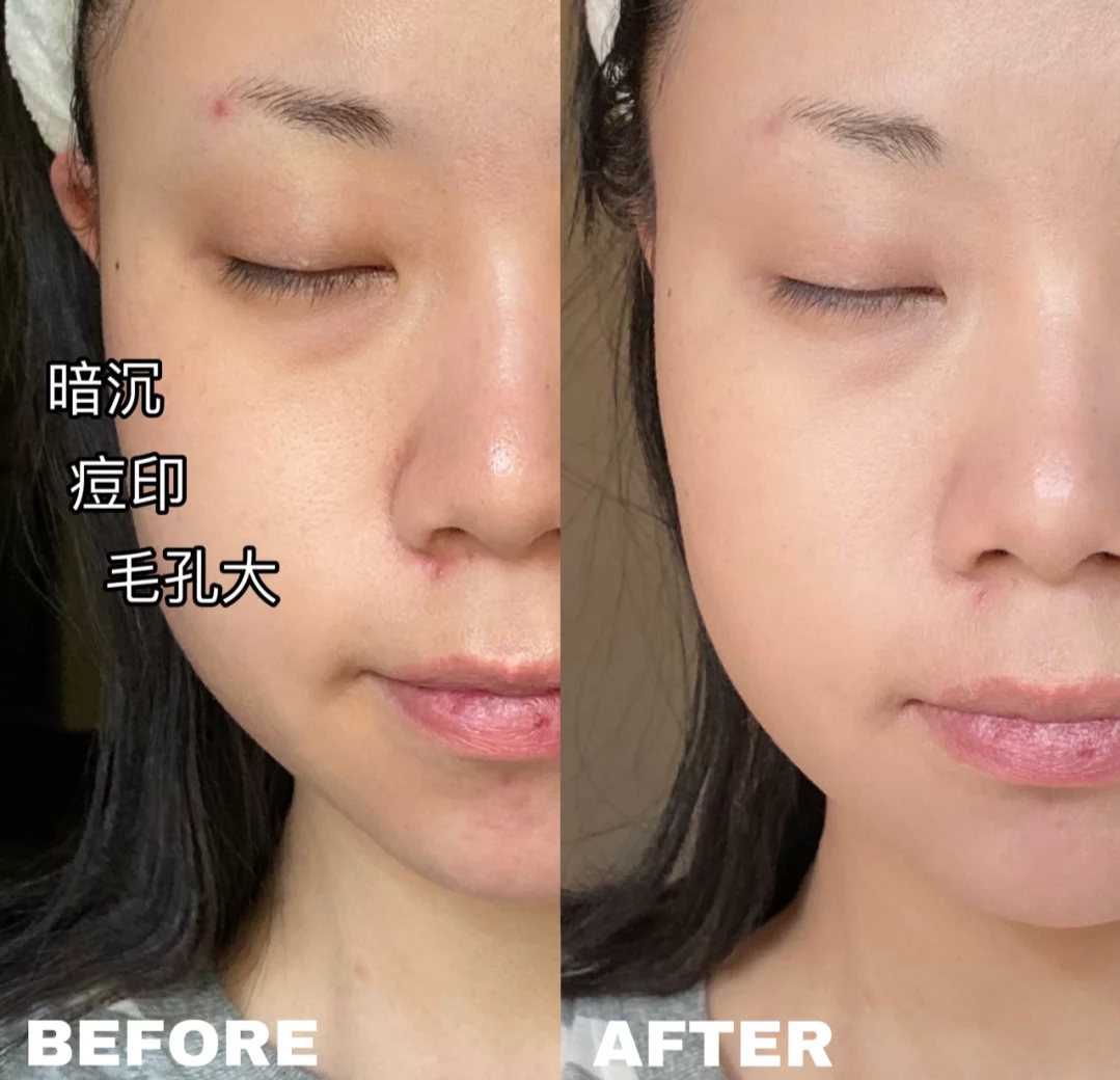 不会闷痘且遮瑕的粉底液测评,绝不踩雷的大牌粉底液