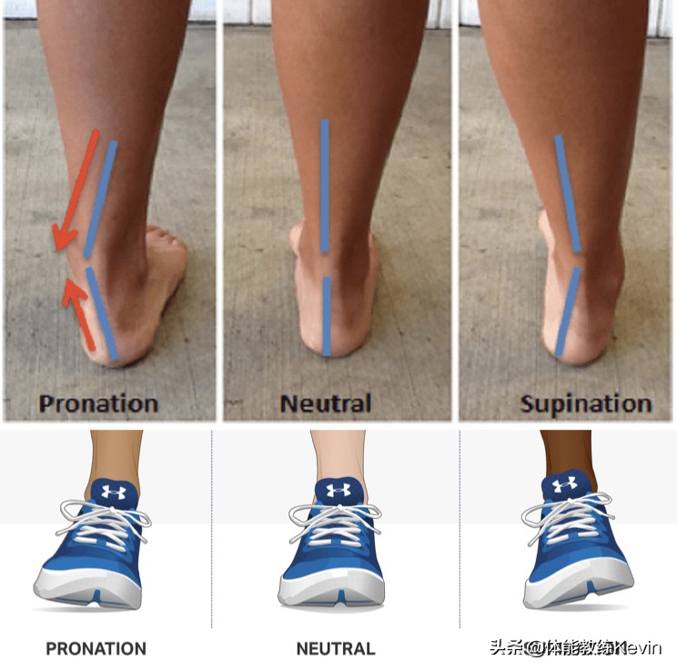 千里之行，始于“足下”——足外翻的5种解决方法