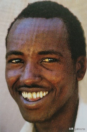 中国最早根治天花,人类彻底消灭天花