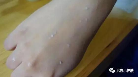 手粗糙怎么办教你一招就变好看,手部粗糙难看教你一招嫩白法