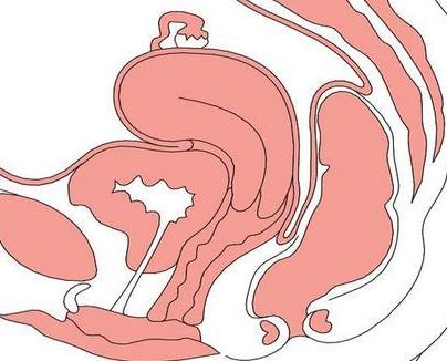 妇科检查宫颈囊肿严重吗,宫颈囊肿的危害有哪些呢