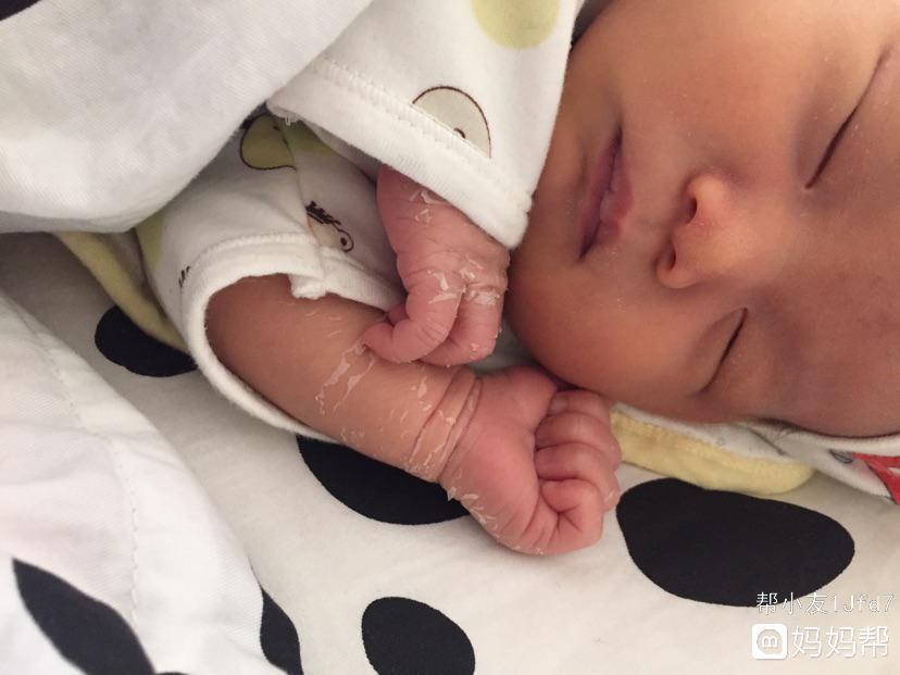 女生脸部常见皮肤问题,新生儿常见皮肤问题及护理试题