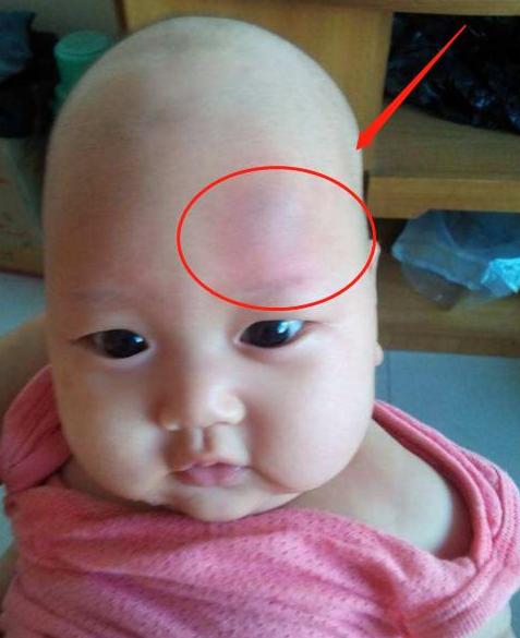 宝宝从床上摔下妈妈内心崩溃,宝宝从床上不慎摔下妈妈立刻惊醒