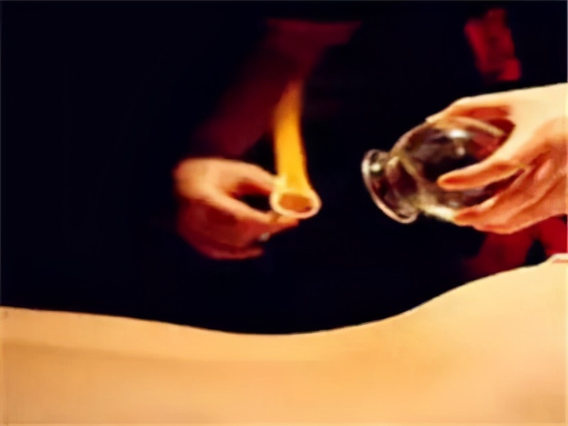 中医针灸推拿能治癌症吗,艾灸针灸拔罐刮痧之间的区别