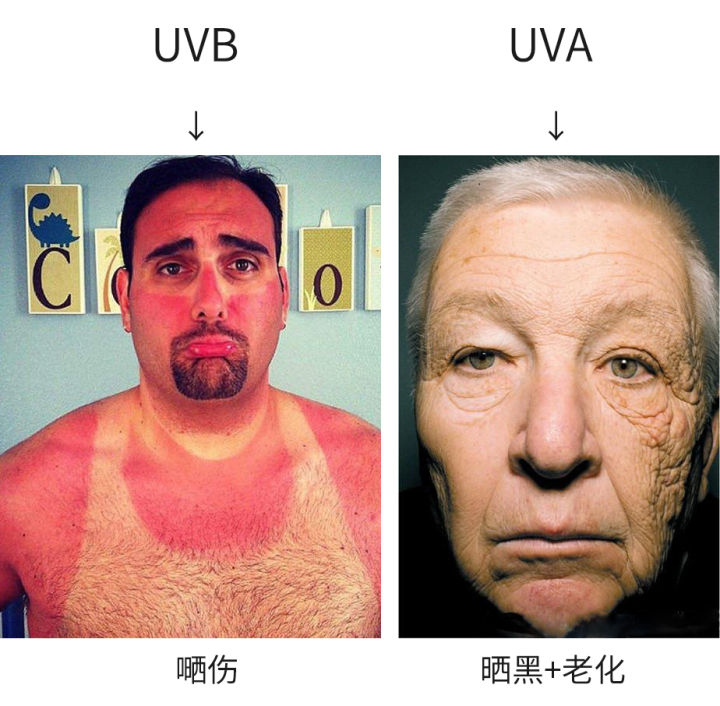 夏天晒黑怎么恢复美白,夏天晒黑了怎么快速变白