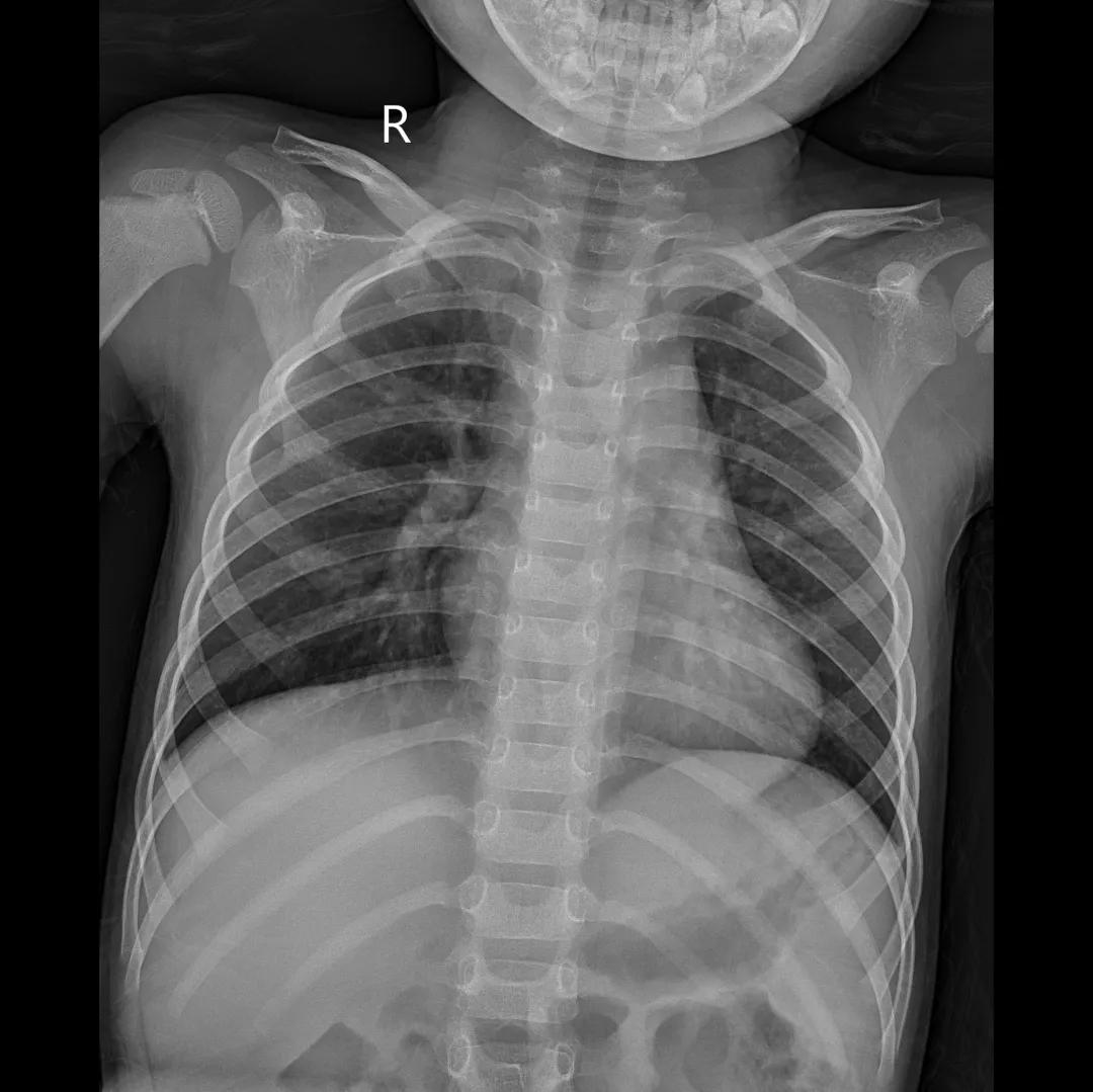安健科技dr拍片质量怎么样,安健科技DR价格