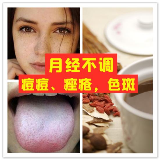 月经褐色怎么食补,经期量少黑褐色怎么调理