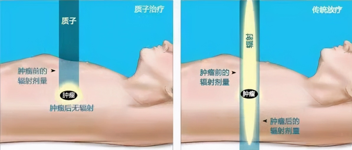 中药治疗放疗的药物有哪些,放疗和中药治疗哪个效果好