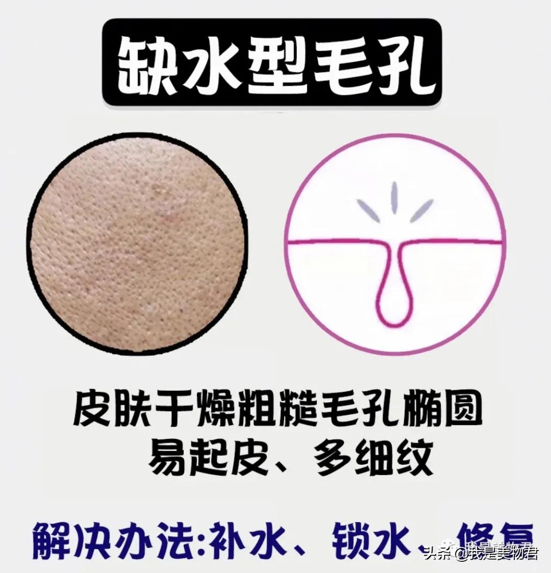 脸上毛孔粗大是什么原因引起的,脸上红血丝毛孔粗大是什么原因