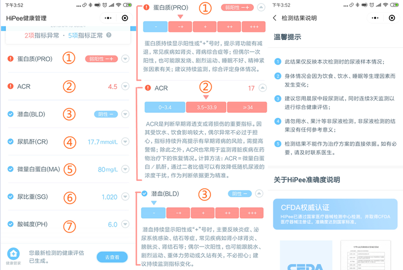 小米hipee智能健康精灵可靠么,小米有品hipee怎么样