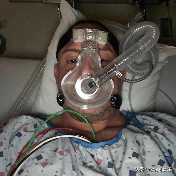 使用类固醇增肌,健美达人类固醇引发肾衰竭