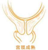 能否顺产要看什么条件,是否能顺产如何评估