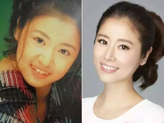 虎牙齿拔不掉怎么办,牙虎