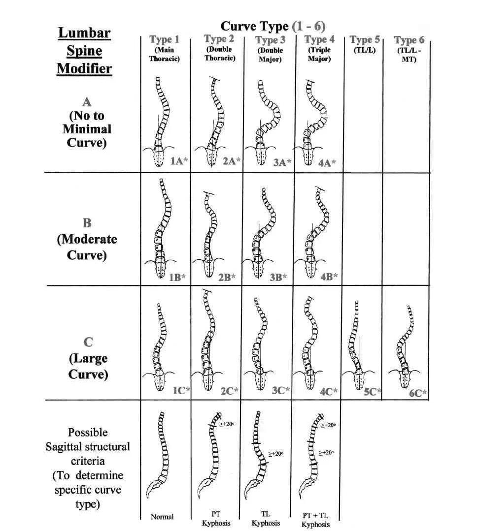 脊柱侧弯高低肩瑜伽运动矫正,瑜伽脊柱侧弯矫正器拉伸使用视频