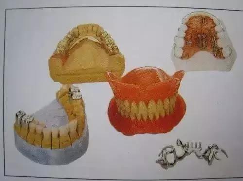 换一副烤瓷牙什么材料比较好,各类烤瓷牙材料的优缺点对比