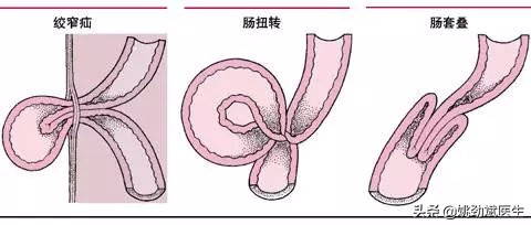 人跳广场舞腰扭了,人跳的广场舞