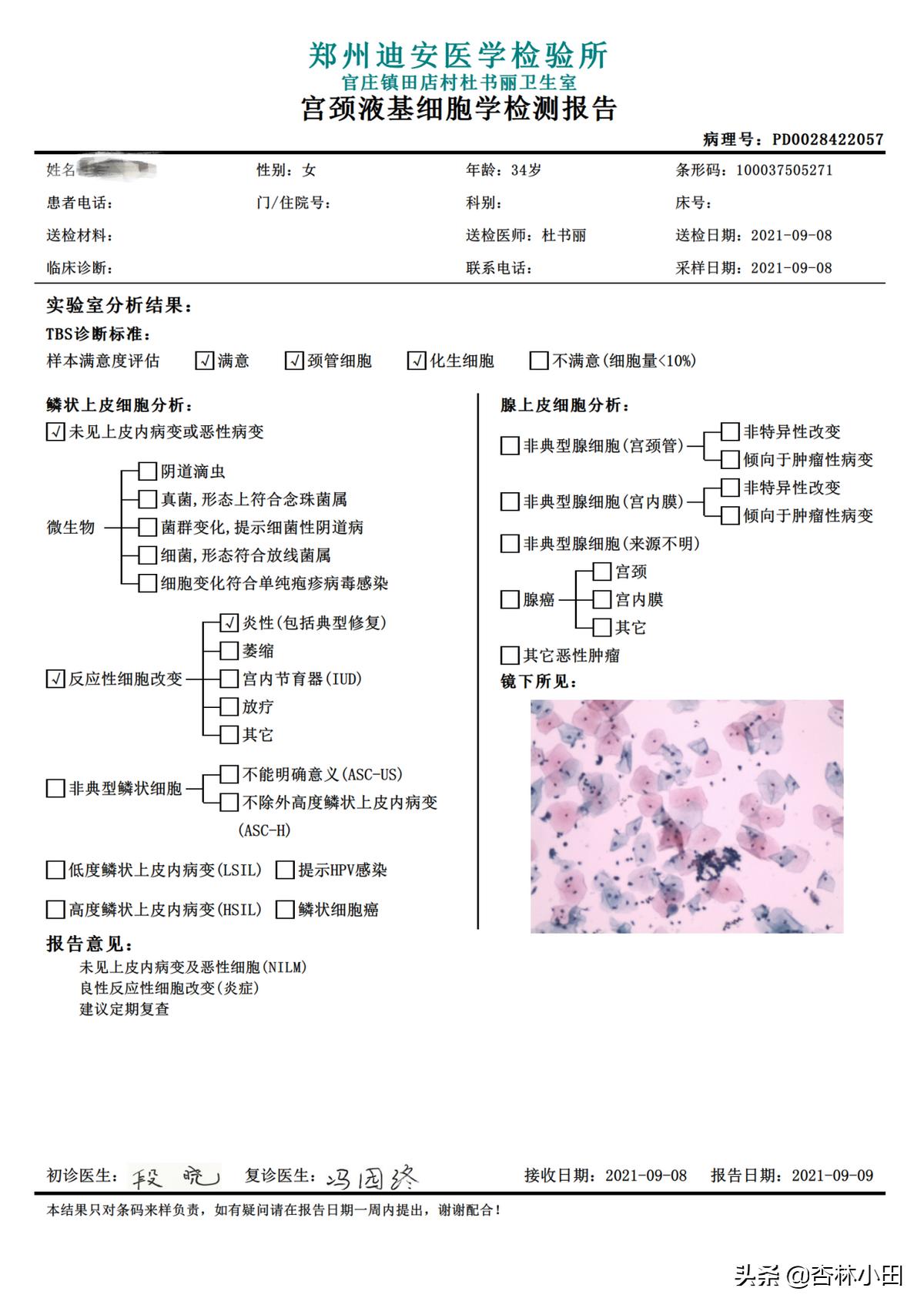 hpv宫颈癌Tct检查有啥注意事项,宫颈癌hpv