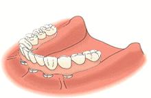 广大口腔公益种牙补贴,领取口腔优惠