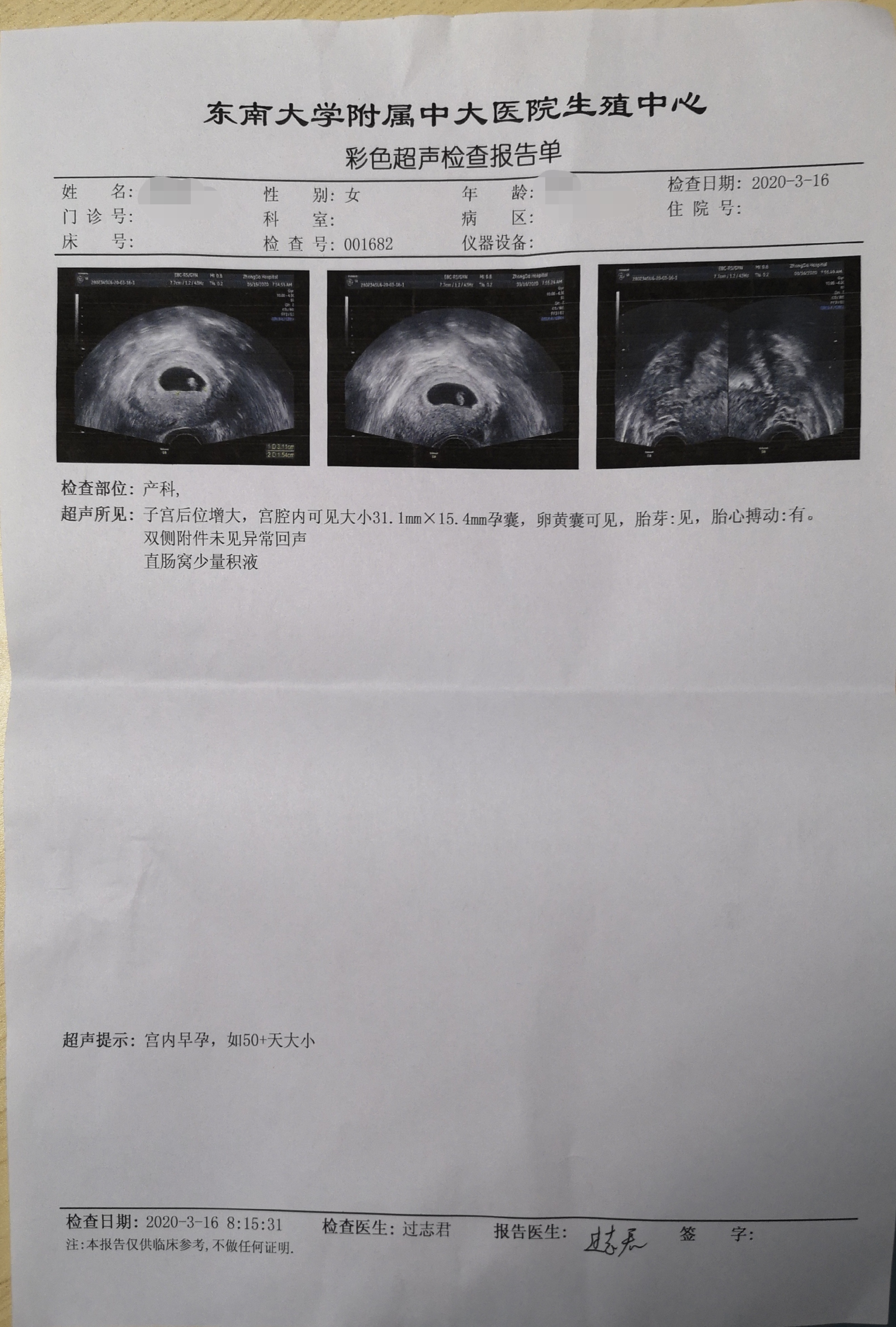 排卵障碍性不孕症的诊疗策略,排卵障碍不孕中最常见的原因是