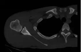 中超运动员受伤,足球黄嘉俊