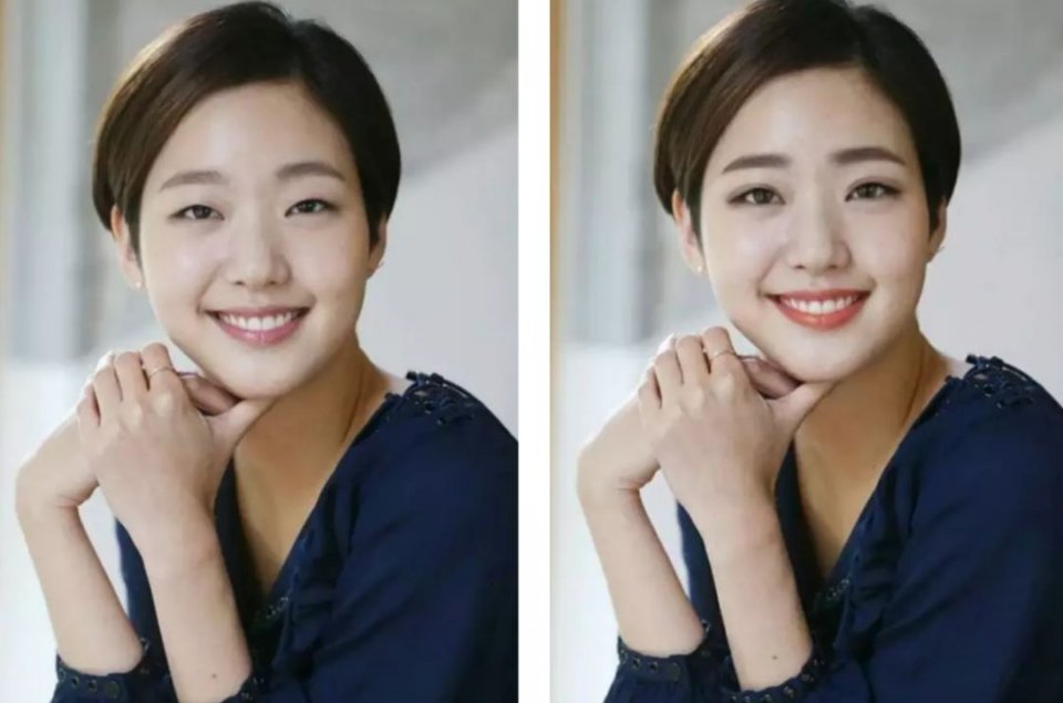 单眼皮怎么整容变双眼皮,嫌弃自己双眼皮小怎么办