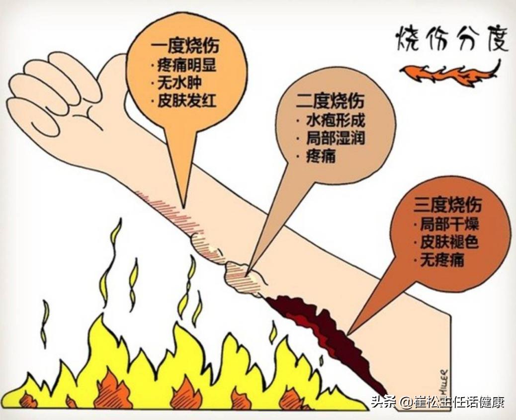 不想去医院第三弹！腹部不适的自我诊察