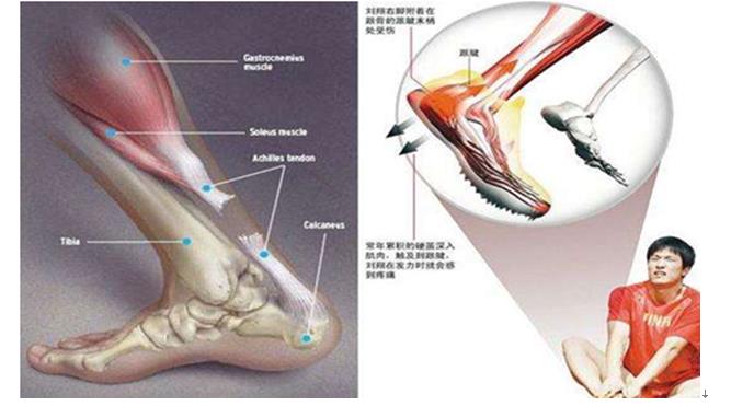 抗菌药物，氟喹诺酮类抗菌药物
