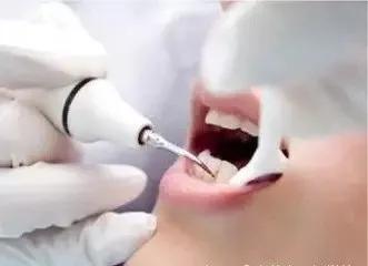 牙齿美容未来的趋势,牙齿美容这个项目前景如何