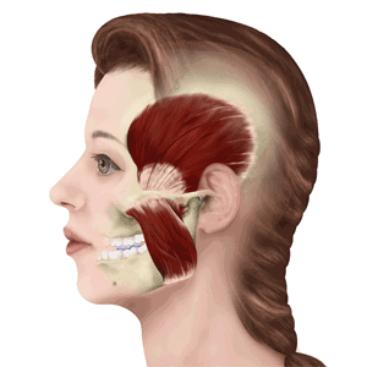 戴牙套的脸型会变丑图,戴牙套会变成巫婆脸吗