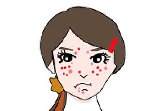 日本抗痘膏狮王,修丽可小绿瓶祛痘测评