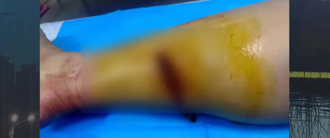 全城寻找有爱心的人,赤峰市救助站寻人视频