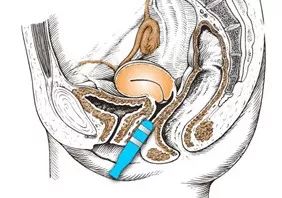 3.8产康店女神节活动方案,3.8女神节送鲜花活动方案