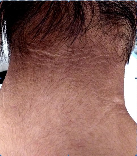 萝莉少女大长腿，为何腿毛长又黑？