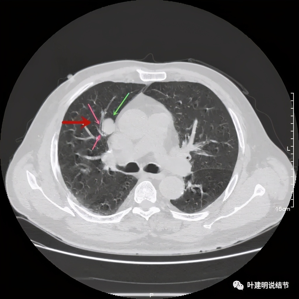 误诊报告图片,误诊案例及案例分析
