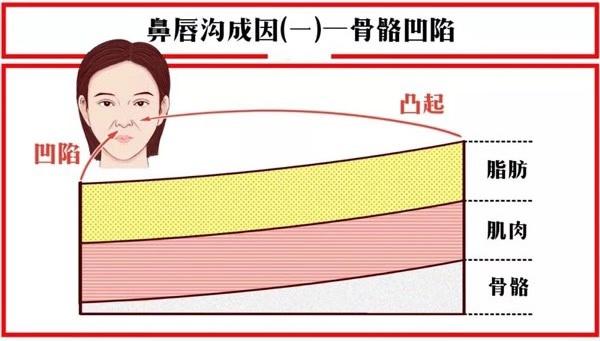 关于法令纹的冷知识,关于法令纹的误解你中招了吗