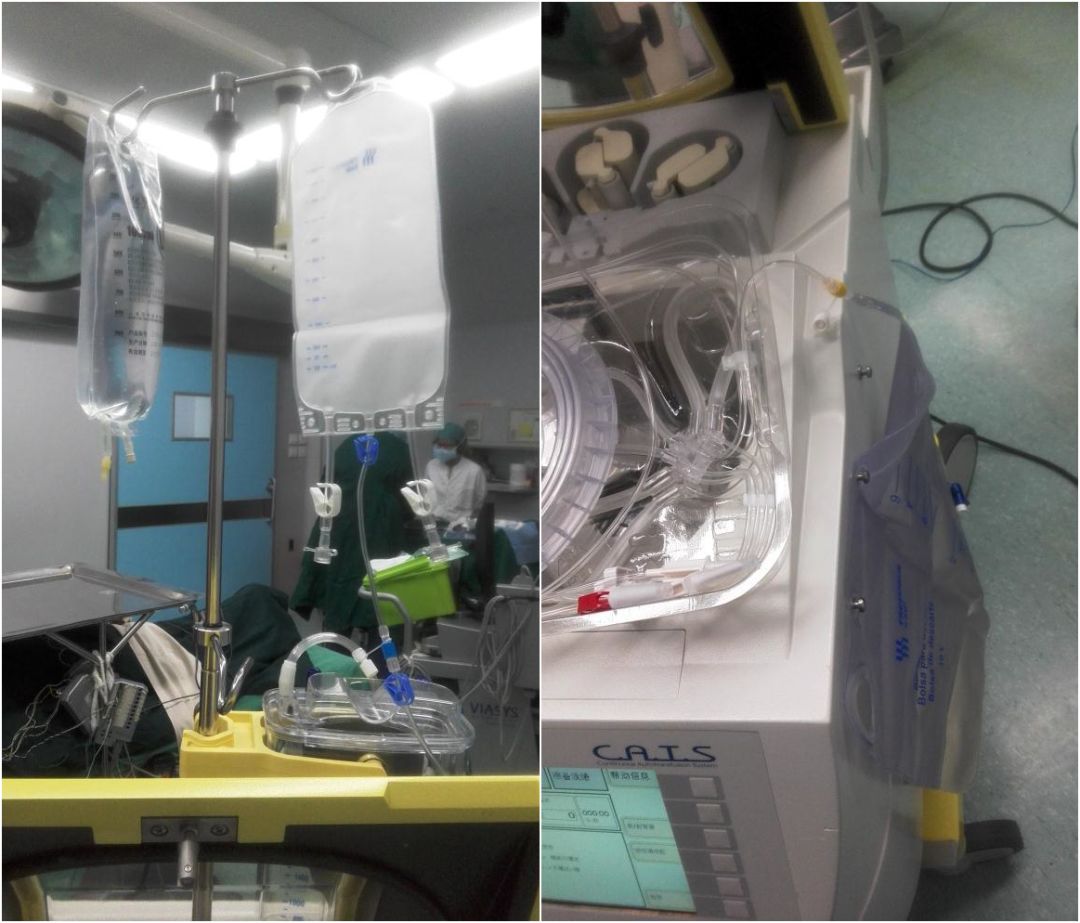 马康:术中自体血液回收