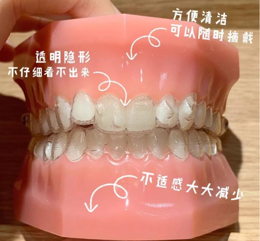 什么情况需要牙齿矫正一般多少钱,为什么去医院矫正牙齿每次都收费