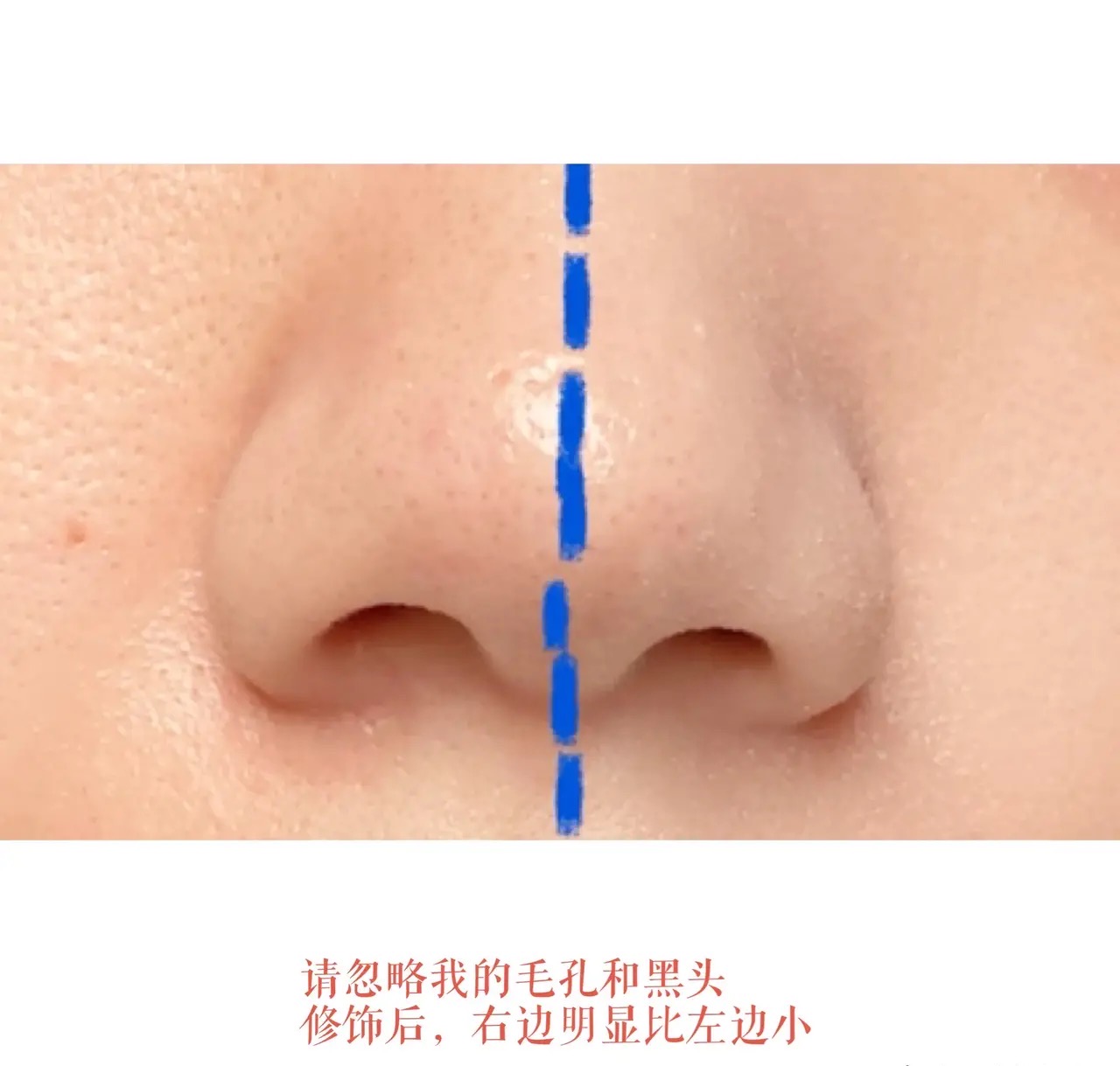 怎么才能让鼻子变小变漂亮,如何高情商夸女生鼻子漂亮