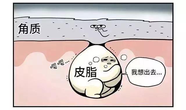 挤闭口粉刺有效吗,挤下巴闭口粉刺