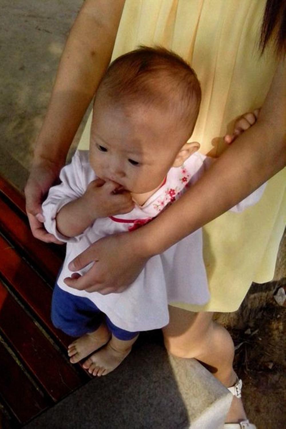 宝宝耳朵有点招风耳怎么办,新生儿睡觉耳朵招风耳可以矫正吗