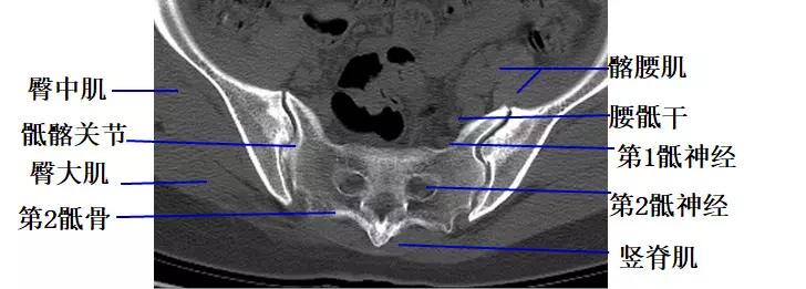 颈椎腰椎疾病ct及mri诊断,腰椎ct可以发现肠部病变吗